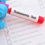 Thalassemia: A Comprehensive Guide to its Symptoms and Treatments