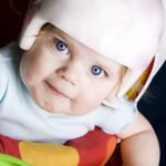 10 FAQs about Plagiocephaly