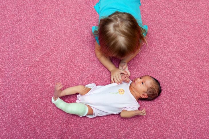 Bird eye view of an older sister laying on her stomach, holding the hand of her baby sister to comfort her. The infant has a cast to correct her congenital club foot.