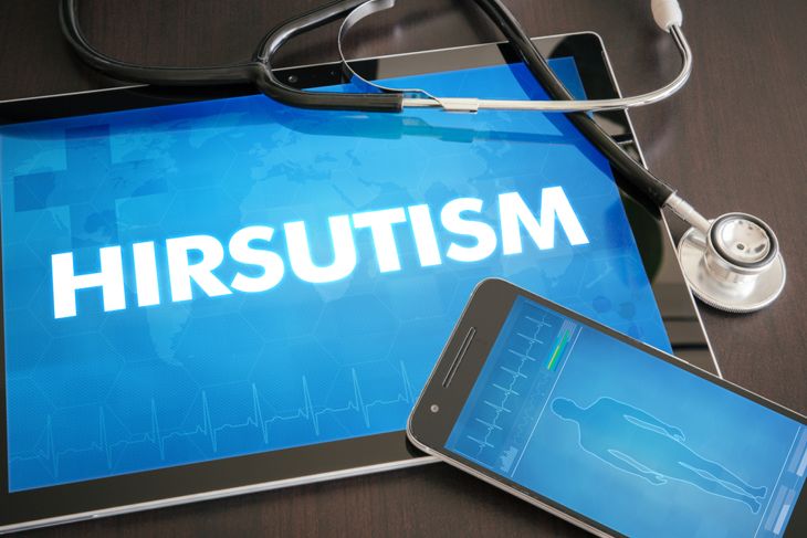 What is Hirsutism? Symptoms and Treatments