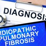 10 Symptoms of Idiopathic Pulmonary Fibrosis (IPF)