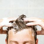 What is Seborrheic Dermatitis? Symptoms and Treatments