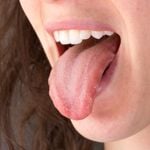 10 Signs You Might Have Burning Mouth Syndrome
