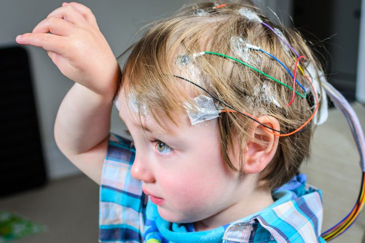 Symptoms and Treatments of Phenylketonuria (PKU)