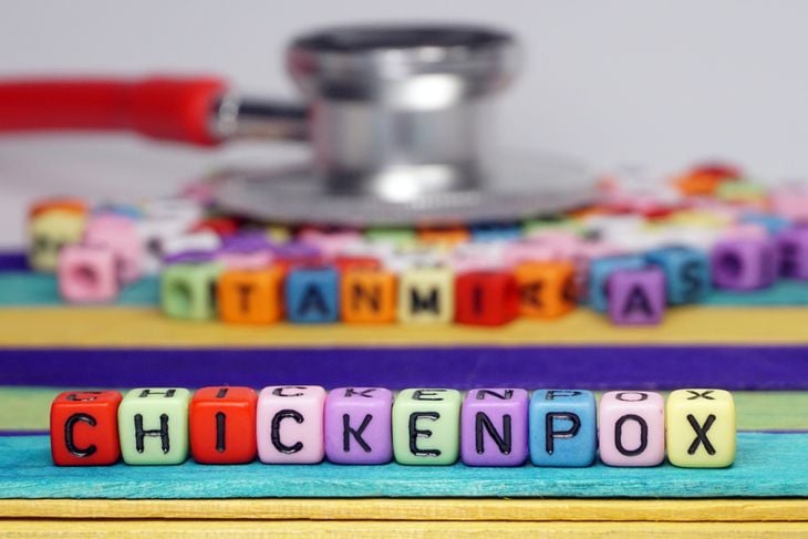 What is Chickenpox? Symptoms and Treatment