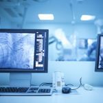 10 Key Points to Know Before Undergoing Angioplasty