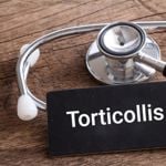 Frequently Asked Questions about Torticollis