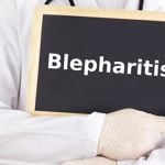 Causes and Symptoms of Blepharitis