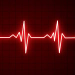 7 Common Symptoms of Bradycardia