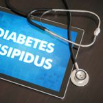 10 FAQs About Diabetes Insipidus