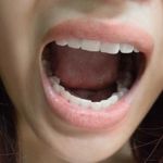 10 Steps for a Halitosis Cure