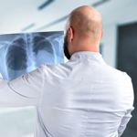 Understanding the Causes of Hip Bursitis