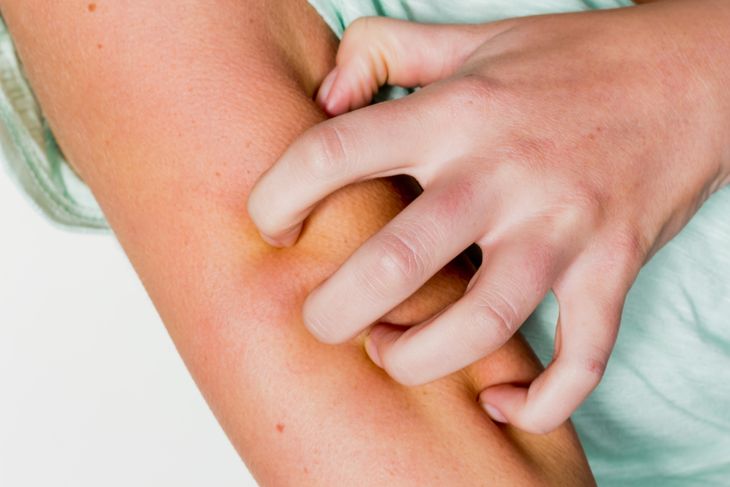 Symptoms and Treatments of Pruritus