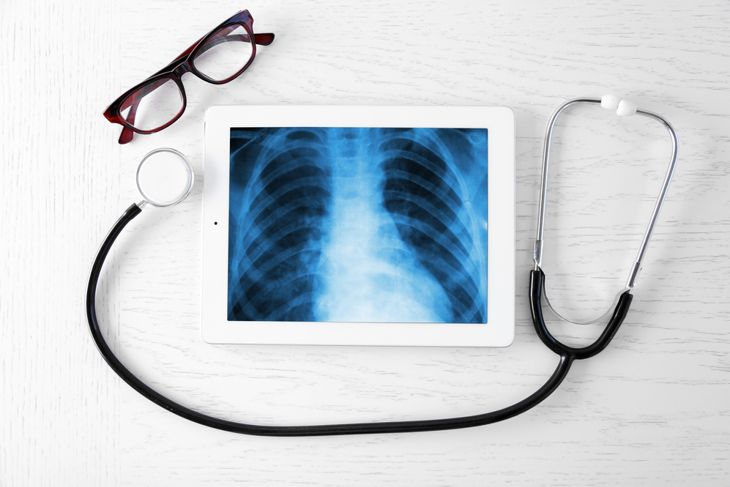 Learn How Bronchiectasis Affects Lung Health