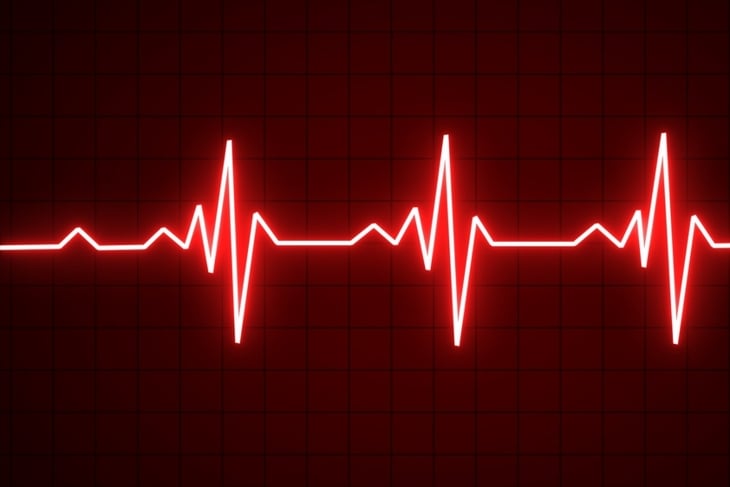 7 Common Symptoms of Bradycardia