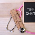 10 Causes, Symptoms, and Treatments of Tinea Capitis