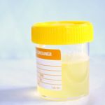 Causes, Symptoms, and Treatments of Cloudy Urine