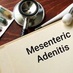 Symptoms, Causes and Treatments for Mesenteric Adenitis