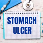 10 Popular Treatments for Stomach Ulcers