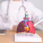 Essential Information on Pleural Effusion: Causes, Symptoms, and Treatments