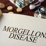 Frequently Asked Questions about Morgellons Disease
