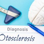 10 Symptoms and Treatments of Otosclerosis