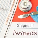 10 Causes, Symptoms, and Treatments: Peritonitis