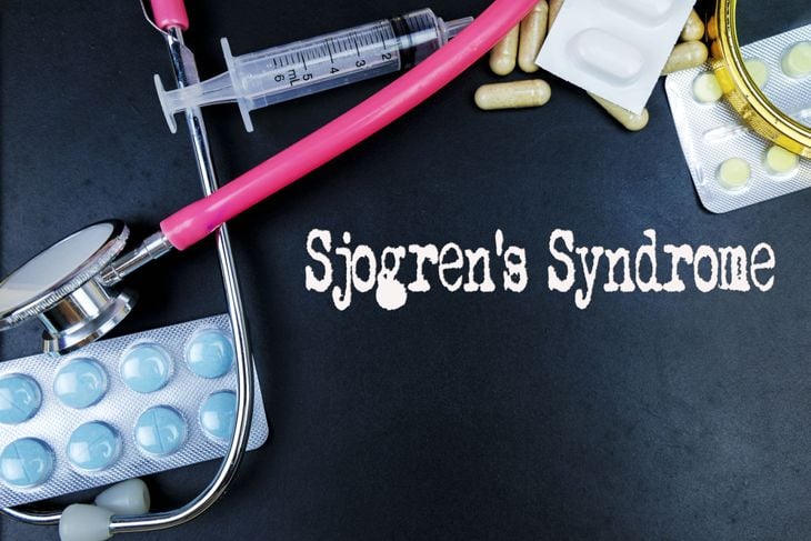 Symptoms and Treatments for Sjogren’s Syndrome