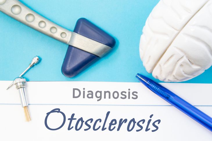 10 Symptoms and Treatments of Otosclerosis