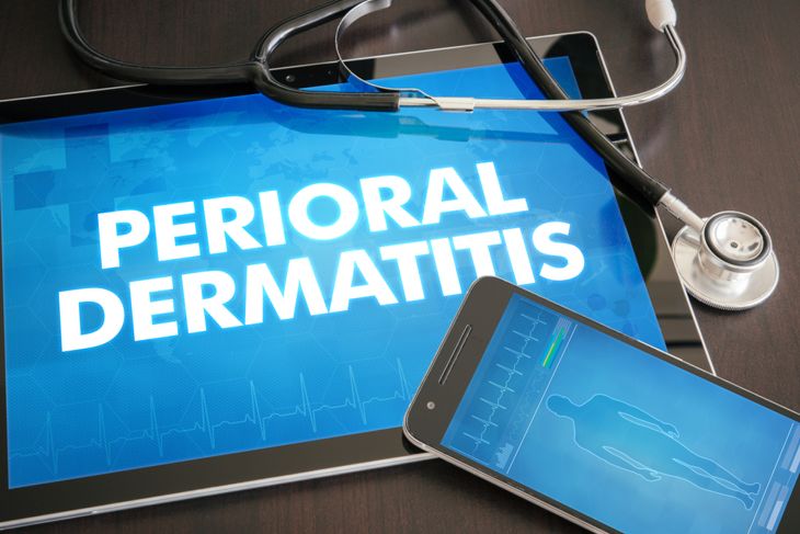 Symptoms, Causes and Treatments of Perioral Dermatitis