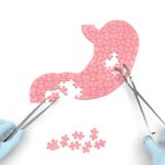 Natural Ways to Relieve Peptic Ulcer Pain
