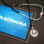 Symptoms and Causes of Prolactinoma