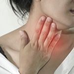 Causes of Swollen Lymph Nodes