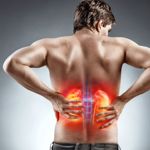 10 Key Triggers of Kidney Pain and How to Alleviate Discomfort