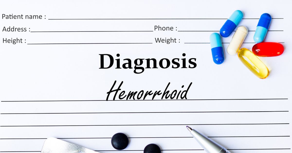 10 Causes and Complications of Hemorrhoids Facty Health