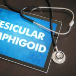 Pemphigoid: Symptoms, Causes, and Treatments