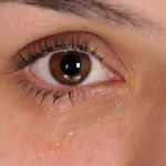 Blocked Tear Ducts: Cause & Treatments