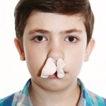 What You Need to Know about Nosebleeds (Epistaxis)