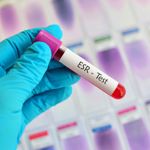 What is an ESR Test?