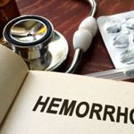 Natural Ways to Relieve Hemorrhoid Symptoms