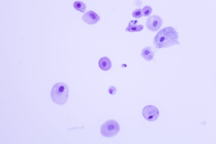 Human normal squamous epithelial cells view in microscopy.Atrophic smear criteria for pap smear slide cytology and pathology