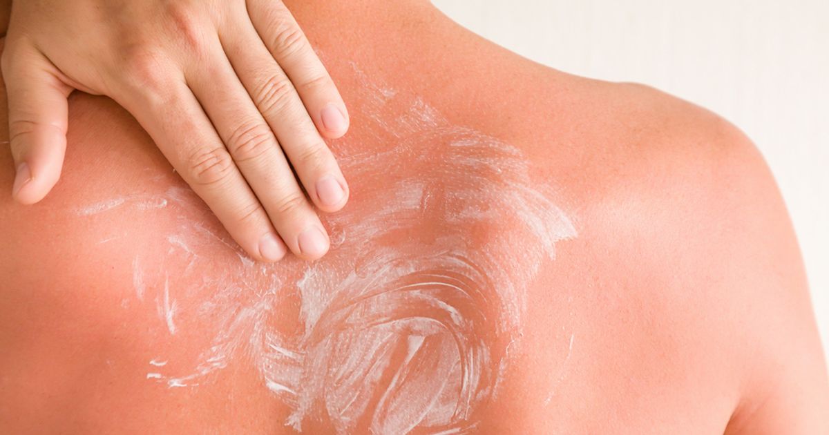 Symptoms and Causes of Polymorphic Light Eruption Facty Health