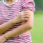 10 Tips for Insect Bite Treatment