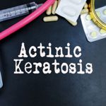 Symptoms and Causes of Solar Keratosis