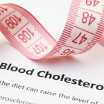 Which of These Causes is Your Reason for High Cholesterol?