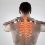 10 FAQs About Neck Pain