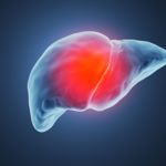 Causes, Symptoms, and Treatments of Liver Pain