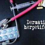 Sensitive to Gluten? 10 FAQs About Dermatitis Herpetiformis