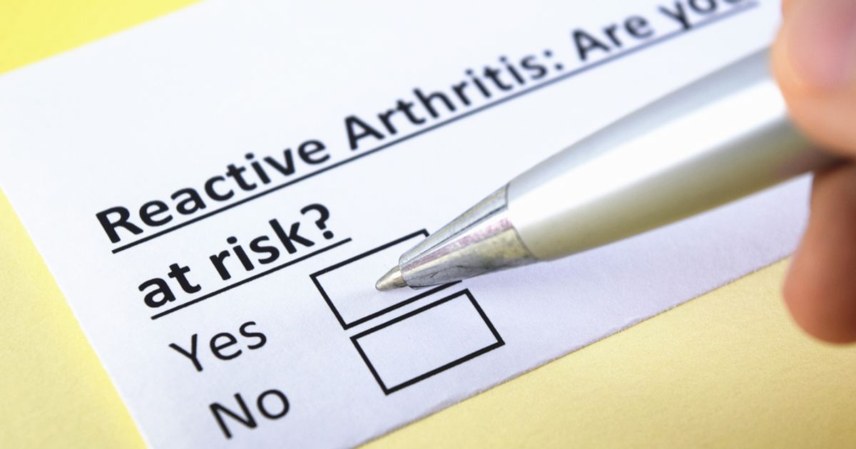 Reactive Arthritis Symptoms, Causes, and Treatments Facty Health