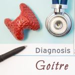 10 Frequently Asked Questions About Goiter